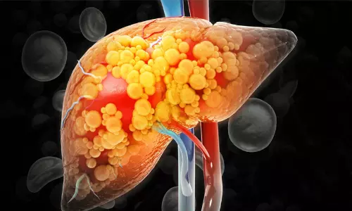 നിങ്ങളുടെ ഹെൽത്ത് റിപ്പോർട്ട് നോർമൽ ആണോ? എങ്കിലും ജാഗ്രത വേണമെന്ന് പുതിയ പഠനം; ഇന്ത്യക്കാരിൽ ഫാറ്റി ലിവർ വർധിക്കുന്നു