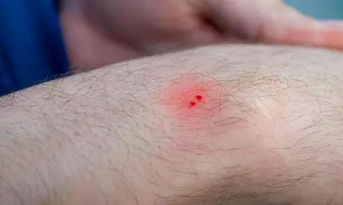 ഇടുക്കിയിൽ രണ്ടുപേർക്ക് പാമ്പ് കടിയേറ്റു