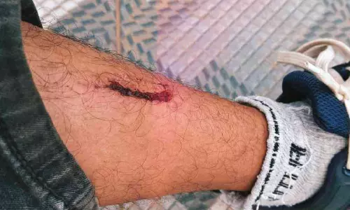 തെരുവുനായ് ആക്രമണം; രണ്ടുപേർക്ക് പരിക്ക്