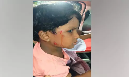 പരപ്പനങ്ങാടിയിൽ തെരുവുനായ് ആക്രമണം; പിഞ്ചുകുട്ടികൾ ഉൾപ്പെടെ എട്ടുപേർക്ക് പരിക്ക്