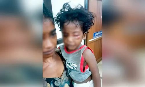 മൂ​ന്നു വ​യ​സ്സു​കാ​രി​യെ​ തെ​രു​വു​നാ​യ്​​ ആ​ക്ര​മി​ച്ചു; പ​ത്ത​നം​തി​ട്ട ജി​ല്ല​യി​ൽ തെ​രു​വു​നാ​യ് ശ​ല്യം രൂ​ക്ഷ​മാ​കു​ന്നു