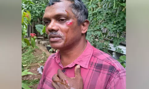 കാട്ടുപന്നി ആക്രമണം; സ്കൂട്ടർ യാത്രികന് പരിക്ക്