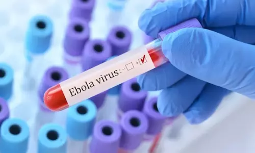 ebola virus