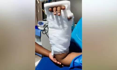 ഭർതൃപിതാവ് വെട്ടിമാറ്റിയ യുവതിയുടെ കൈപ്പത്തി തുന്നിച്ചേർത്തു