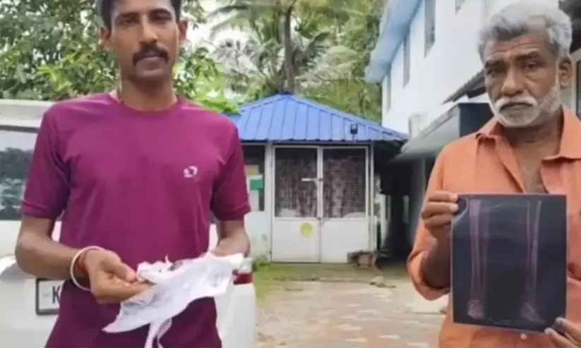 ചികിത്സാപ്പിഴവ്? കാലിൽ തറച്ചുകയറിയ മരക്കഷണവുമായി മധ്യവയസ്കൻ കഴിഞ്ഞത് മാസങ്ങളോളം ചികിത്സാപ്പിഴവ്? കാലിൽ തറച്ചുകയറിയ മരക്കഷണവുമായി മധ്യവയസ്കൻ കഴിഞ്ഞത് മാസങ്ങളോളം