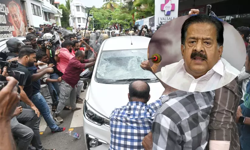 Ramesh Chennithala Ramesh Chennithala