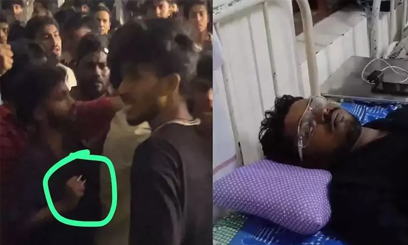 കോളജ് ഡേ പരിപാടിയിൽ പുറത്തുനിന്നെത്തിയവരുടെ അക്രമം; വിദ്യാർഥിയുടെ കാഴ്ച നഷ്ടപ്പെട്ടു കോളജ് ഡേ പരിപാടിയിൽ പുറത്തുനിന്നെത്തിയവരുടെ അക്രമം; വിദ്യാർഥിയുടെ കാഴ്ച നഷ്ടപ്പെട്ടു