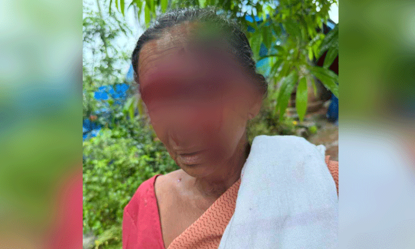 വീടിനുള്ളിൽ കയറിയ തെരുവുനായ് വയോധികയെ ആക്രമിച്ചു വീടിനുള്ളിൽ കയറിയ തെരുവുനായ് വയോധികയെ ആക്രമിച്ചു