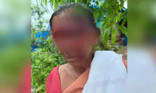 വീടിനുള്ളിൽ കയറിയ തെരുവുനായ് വയോധികയെ ആക്രമിച്ചു