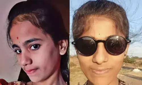 മാമ്പഴം കഴിച്ച സഹോദരിമാർ ഹൈദരാബാദിൽ മരിച്ചു മാമ്പഴം കഴിച്ച സഹോദരിമാർ ഹൈദരാബാദിൽ മരിച്ചു