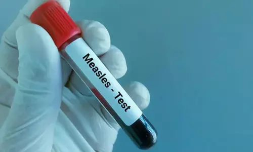 അഞ്ചാം പനി ആശങ്കയിൽ ബംഗ്ലാദേശ്: ശനിയാഴ്ച മരിച്ച അഞ്ച് കുട്ടികൾക്ക് രോഗബാധയെന്ന് സംശയം, മാർച്ച് മുതൽ രോഗലക്ഷണങ്ങളോടെ മരണപ്പെട്ടത് 584 പേർ