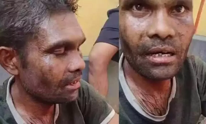 വാളയാർ ആൾക്കൂട്ട കൊലപാതകം: അന്വേഷണം അട്ടിമറിക്കപ്പെടാതിരിക്കാൻ സർക്കാർ ഇടപെടണമെന്ന് കുടുംബം വാളയാർ ആൾക്കൂട്ട കൊലപാതകം: അന്വേഷണം അട്ടിമറിക്കപ്പെടാതിരിക്കാൻ സർക്കാർ ഇടപെടണമെന്ന് കുടുംബം