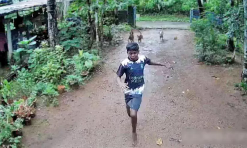 തെരുവുനായ് ആക്രമണം; കാഞ്ഞിരക്കോട് വിദ്യാർഥി രക്ഷപ്പെട്ടത് തലനാരിഴക്ക് തെരുവുനായ് ആക്രമണം; കാഞ്ഞിരക്കോട് വിദ്യാർഥി രക്ഷപ്പെട്ടത് തലനാരിഴക്ക്