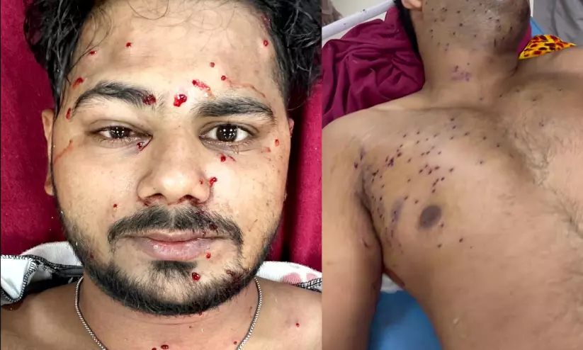 വിദ്യാർഥികൾക്ക് നേരെ പെല്ലറ്റ് ക്രൂരതയും; കശ്മീരിൽ പ്രയോഗിച്ച പെല്ലറ്റ് തോക്കുകൾ ഉപയോഗിച്ചു; നിരവധി പേർക്ക് സാരമായ പരിക്ക് വിദ്യാർഥികൾക്ക് നേരെ പെല്ലറ്റ് ക്രൂരതയും; കശ്മീരിൽ പ്രയോഗിച്ച പെല്ലറ്റ് തോക്കുകൾ ഉപയോഗിച്ചു; നിരവധി പേർക്ക് സാരമായ പരിക്ക്