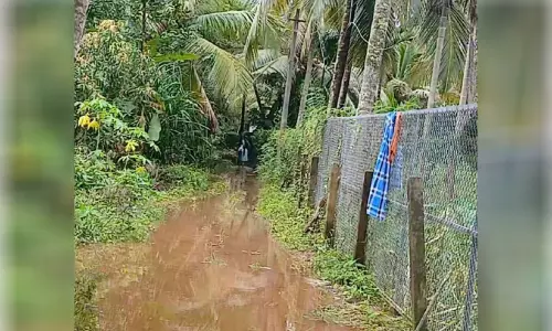 പൊ​ട്ടി​വീ​ണ വൈ​ദ്യു​തി​ക്ക​മ്പി​യി​ൽ ത​ട്ടി 12കാ​രി​ക്ക് ഷോ​ക്കേ​റ്റു