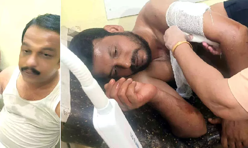 ഇൻസ്റ്റഗ്രാം കമന്റിനെച്ചൊല്ലി സംഘർഷം; പിടിച്ചുമാറ്റാനെത്തിയവർക്ക് കുത്തേറ്റു ഇൻസ്റ്റഗ്രാം കമന്റിനെച്ചൊല്ലി സംഘർഷം; പിടിച്ചുമാറ്റാനെത്തിയവർക്ക് കുത്തേറ്റു