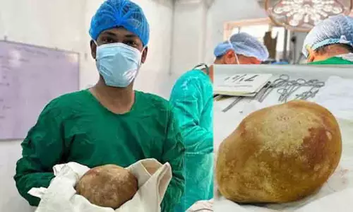 55കാരന്റെ മൂത്രാശയത്തിൽനിന്ന് നീക്കം ചെയ്തത് 3.1 കിലോ കല്ല്; ഇതുവരെ കണ്ടതിൽ വെച്ച് ഏറ്റവും വലുത് 55കാരന്റെ മൂത്രാശയത്തിൽനിന്ന് നീക്കം ചെയ്തത് 3.1 കിലോ കല്ല്; ഇതുവരെ കണ്ടതിൽ വെച്ച് ഏറ്റവും വലുത്