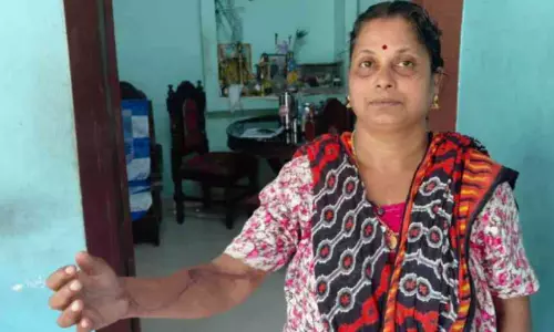 കാല് വേദനയുമായി എത്തിയ വീട്ടമ്മക്ക് ആന്റിവെനം കുത്തിവെച്ചു; കൈയുടെ ചലനശേഷി നഷ്ടമായെന്ന് പരാതി കാല് വേദനയുമായി എത്തിയ വീട്ടമ്മക്ക് ആന്റിവെനം കുത്തിവെച്ചു; കൈയുടെ ചലനശേഷി നഷ്ടമായെന്ന് പരാതി