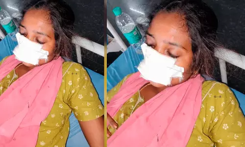 Man Bites Wifes Nose