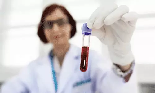 പനിയും കടുത്ത ക്ഷീണവും നിസ്സാരമാക്കരുത്; രക്താർബുദത്തിന്റെ പ്രധാന ലക്ഷണങ്ങളാകാം പനിയും കടുത്ത ക്ഷീണവും നിസ്സാരമാക്കരുത്; രക്താർബുദത്തിന്റെ പ്രധാന ലക്ഷണങ്ങളാകാം