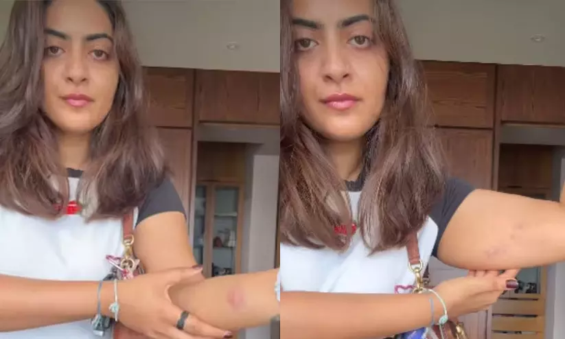 ആമിർ ഖാന്റെ അനന്തരവൾ സെയ്ൻ മാരിക്ക് പൊലീസ് നടപടിയിൽ പരിക്ക്; മുംബൈ പ്രതിഷേധത്തിനിടെയാണ് കസ്റ്റഡിയിലെടുത്തത് ആമിർ ഖാന്റെ അനന്തരവൾ സെയ്ൻ മാരിക്ക് പൊലീസ് നടപടിയിൽ പരിക്ക്; മുംബൈ പ്രതിഷേധത്തിനിടെയാണ് കസ്റ്റഡിയിലെടുത്തത്