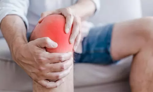 Arthritis