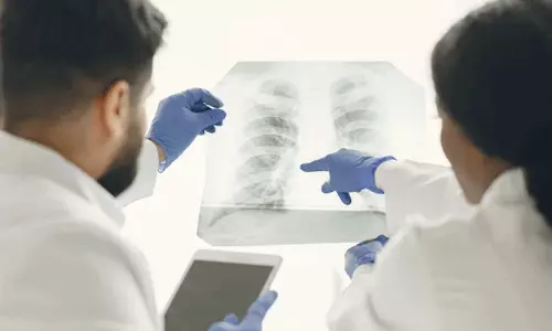 എക്സ്റേയിലെ സൂക്ഷ്മ മാറ്റങ്ങൾ തിരിച്ചറിയും; ക്ഷയരോഗവും ശ്വാസകോശ അർബുദവും കണ്ടെത്താൻ എ ഐ