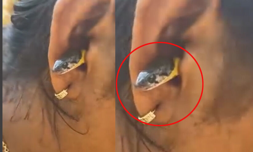 തലശ്ശേരിയിൽ യുവതിയുടെ ചെവിയിൽ പാമ്പ്: വസ്തുത അറിയാം -VIDEO തലശ്ശേരിയിൽ യുവതിയുടെ ചെവിയിൽ പാമ്പ്: വസ്തുത അറിയാം -VIDEO