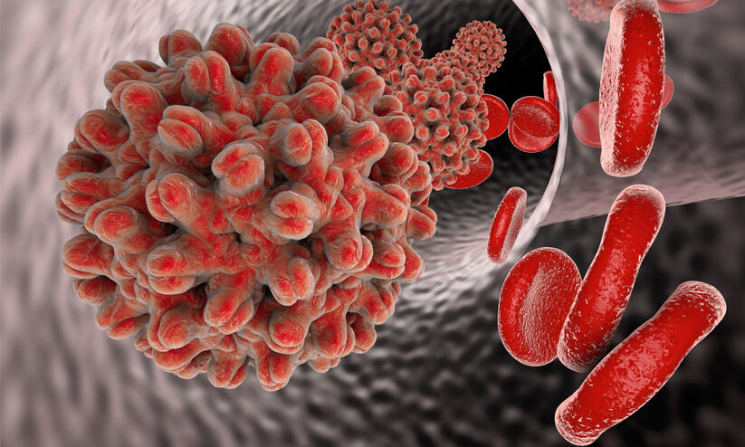 വടകരയിൽ മഞ്ഞപ്പിത്തം പടരുന്നു; സ്വകാര്യ ആശുപത്രിയിലെ 20 ഓളം ജീവനക്കാർക്ക് രോഗബാധ