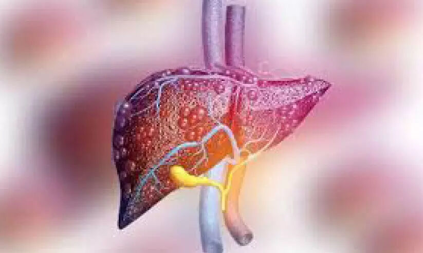 പെരിങ്ങത്തൂർ മേഖലയിൽ മഞ്ഞപ്പിത്തം പടരുന്നു