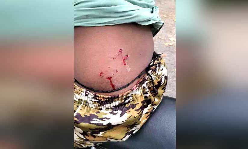 ഭീഷണിയായി നീർനായും; മത്സ്യത്തൊഴിലാളികളും നാട്ടുകാരും ഭീതിയിലാണ് ഭീഷണിയായി നീർനായും; മത്സ്യത്തൊഴിലാളികളും നാട്ടുകാരും ഭീതിയിലാണ്