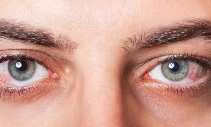 പ്ര​മേ​ഹ​വും കാ​ഴ്ച​യും