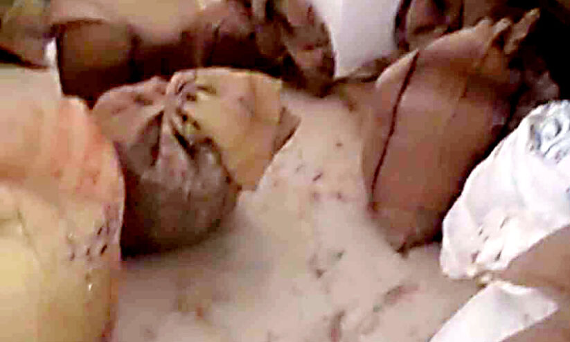 റേ​ഷ​ന്‍ക​ട​വ​ഴി വി​ത​ര​ണം ചെ​യ്ത​ത് പു​ഴു​നി​റ​ഞ്ഞ ധാ​ന്യം