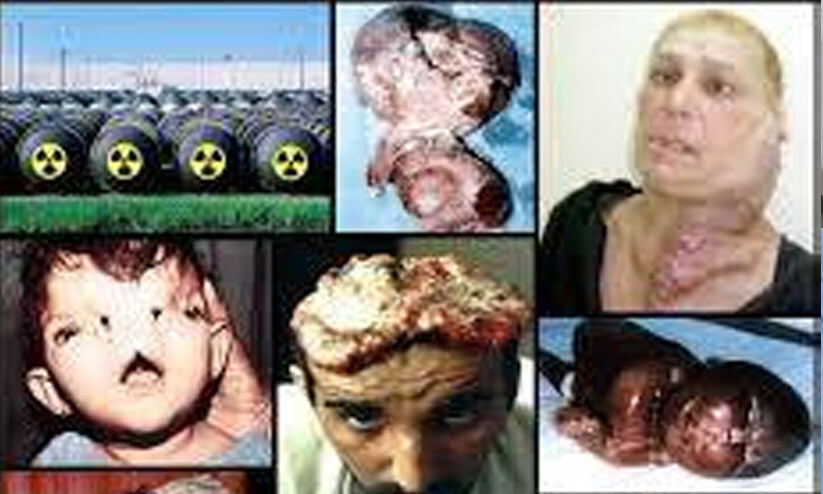 ‘ആണവ യുദ്ധങ്ങള് അവസാനിച്ചുവോ? എങ്കില് ഗസ്സയില് നിങ്ങള് പ്രയോഗിച്ചുകൊണ്ടിരിക്കുന്നതെന്താണ്?’ ‘ആണവ യുദ്ധങ്ങള് അവസാനിച്ചുവോ? എങ്കില് ഗസ്സയില് നിങ്ങള് പ്രയോഗിച്ചുകൊണ്ടിരിക്കുന്നതെന്താണ്?’