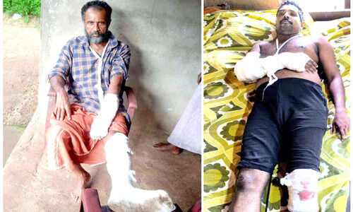 കാട്ടുപന്നി ആക്രമണത്തിൽ രണ്ടുപേര്‍ക്ക് പരിക്ക്