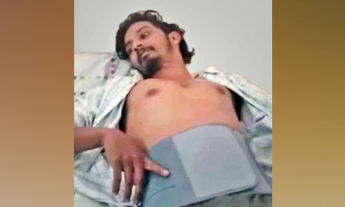 ആയഞ്ചേരിയിൽ യുവാവിനെ തട്ടിക്കൊണ്ടുപോയി മർദിച്ചു