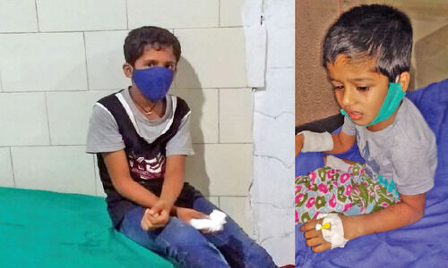 ഉരുവച്ചാലിൽ നാലുപേർക്ക്​ നായുടെ കടിയേറ്റു