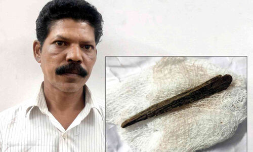 കാലിൽ തറച്ച മരക്കമ്പ് നീക്കാതെ മുറിവ് തുന്നിക്കെട്ടി; അധികൃതരുടെ അനാസ്ഥയിൽ വേദന തിന്നത് അഞ്ചുമാസം