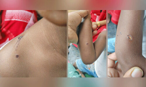 പൊഴുതനയിൽ തെരുവുനായ് ശല്യം, നിരവധി പേർക്ക് കടിയേറ്റു പൊഴുതനയിൽ തെരുവുനായ് ശല്യം, നിരവധി പേർക്ക് കടിയേറ്റു