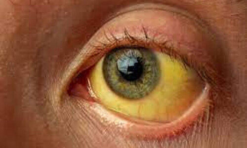 വ​ട​ക്കു​മ്പാ​ട് എ​ച്ച്.​എ​സ്.​എ​സി​ൽ മ​ഞ്ഞ​പ്പി​ത്ത പ്ര​തി​രോ​ധം ശ​ക്തം