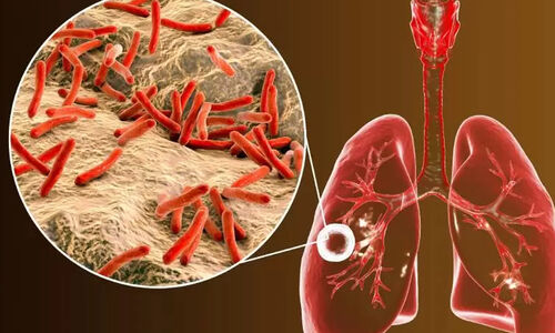 ക്ഷയരോഗം ഇനി ഒന്നരമണിക്കൂറിനുള്ളിൽ കണ്ടെത്താം; പി.സി.ആർ മെഷീൻ സ്ഥാപിച്ച് കലയ്ക്കോട് ആരോഗ്യ കേന്ദ്രം