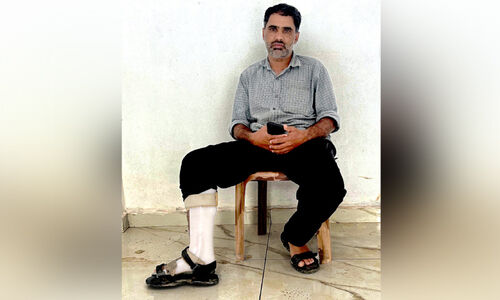 ആരോഗ്യവകുപ്പിന്റെ അനാസ്ഥ; ഹാഷിമിന് നഷ്ടമായത് കാലും ജോലിയും