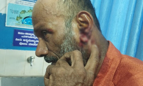 കാട്ടുപന്നി ആക്രമണം; മധ്യവയസ്കന് പരിക്ക് കാട്ടുപന്നി ആക്രമണം; മധ്യവയസ്കന് പരിക്ക്