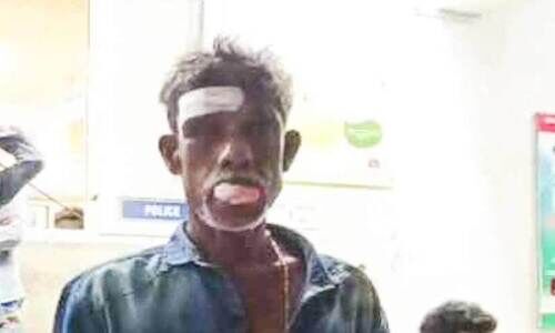 അക്രമി സംഘം വീടുകയറി മർദ്ദിച്ചു; രണ്ടുപേർക്ക് പരിക്ക് അക്രമി സംഘം വീടുകയറി മർദ്ദിച്ചു; രണ്ടുപേർക്ക് പരിക്ക്