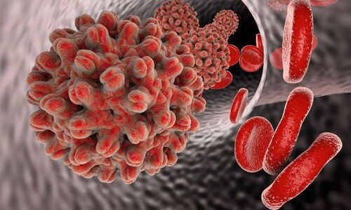 വടകരയിൽ മഞ്ഞപ്പിത്തം പടരുന്നു; സ്വകാര്യ ആശുപത്രിയിലെ 20 ഓളം ജീവനക്കാർക്ക് രോഗബാധ