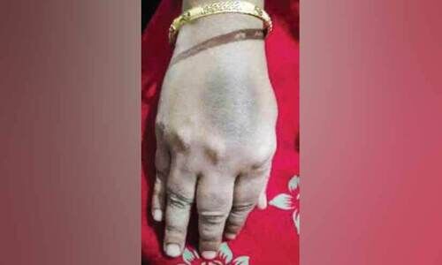 രോ​ഗി​യോ​ട് അ​പ​മ​ര്യാ​ദ​യാ​യി പെ​രു​മാ​റി​യെ​ന്ന്