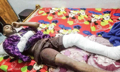 ദേശീയ കായികതാരമായ വിദ്യാർഥിയെ മർദിച്ചതായി പരാതി ദേശീയ കായികതാരമായ വിദ്യാർഥിയെ മർദിച്ചതായി പരാതി