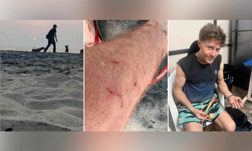 ആലപ്പുഴക്ക്​ നാണക്കേടാകും; പട്ടി കടിച്ചത് ആരോടും പറയേണ്ടെന്ന്​ വിദേശി യു​വാ​വ്