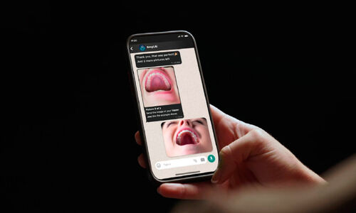 ദ​ന്ത​പ​രി​ശോ​ധ​ന ഇ​നി വാ​ട്സ്ആ​പി​ലൂ​ടെ; ‘സ്‌​മൈ​ല്‍ എ.​ഐ’ അ​വ​ത​രി​പ്പി​ച്ച് ആ​സ്റ്റ​ര്‍ ക്ലി​നി​ക്സ്