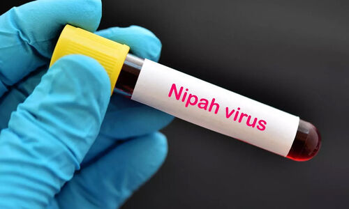 മരിച്ച മങ്കട സ്വദേശിനിയുടെ നിപ ഫലം പോസിറ്റീവ്; പോസ്റ്റ്മോർട്ടം നടത്തിയ ഡോക്ടർമാർ ഉൾപ്പെടെ ക്വാറന്റീനിൽ മരിച്ച മങ്കട സ്വദേശിനിയുടെ നിപ ഫലം പോസിറ്റീവ്; പോസ്റ്റ്മോർട്ടം നടത്തിയ ഡോക്ടർമാർ ഉൾപ്പെടെ ക്വാറന്റീനിൽ